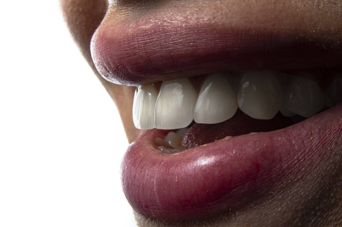 Gros plan de dents soignees apres un soin conservateur